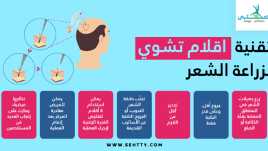 تقنية اقلام تشوي لزراعة الشعر