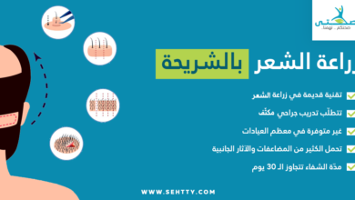 زراعة الشعر بالشريحة