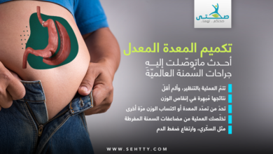 تكميم المعدة المعدل