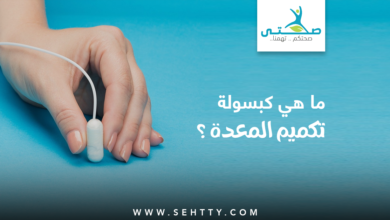 كبسولة تكميم المعدة