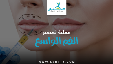عملية تصغير الفم الواسع