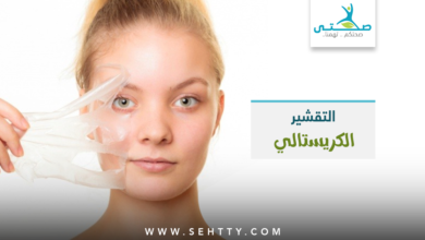 التقشير الكريستالي