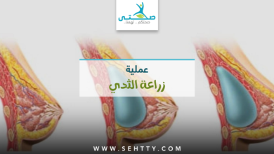 عملية زراعة الثدي