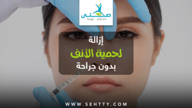 إزالة لحمية الأنف بدون جراحة